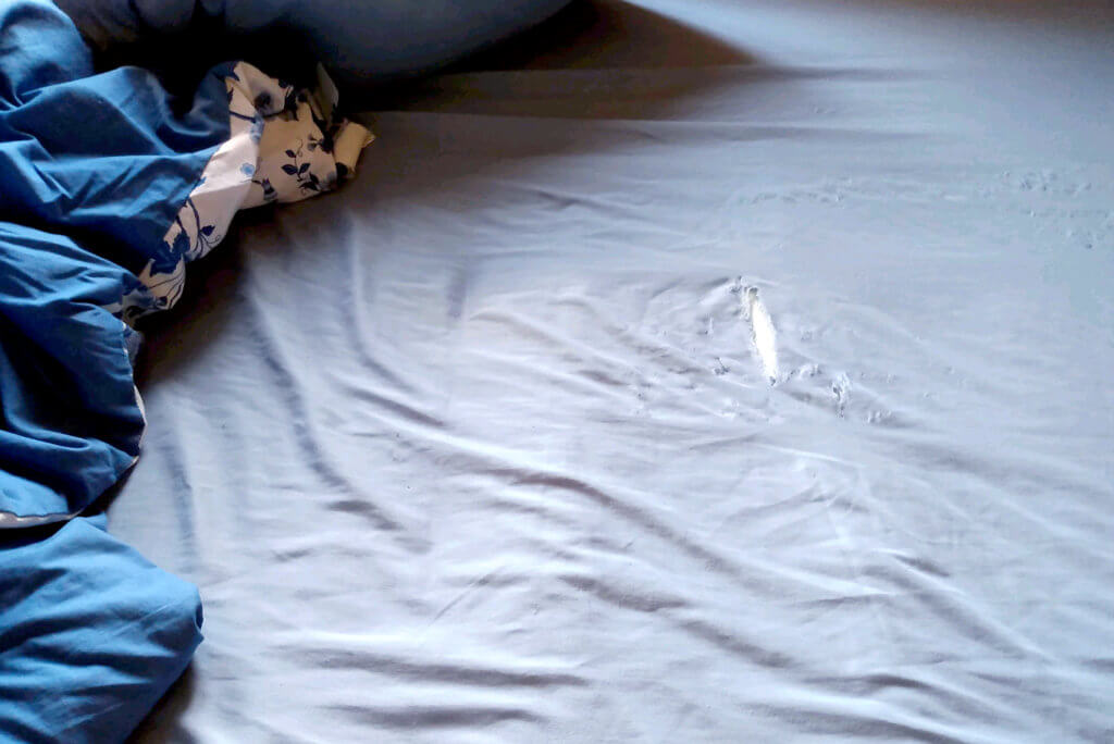 The blue bed sheet was tore