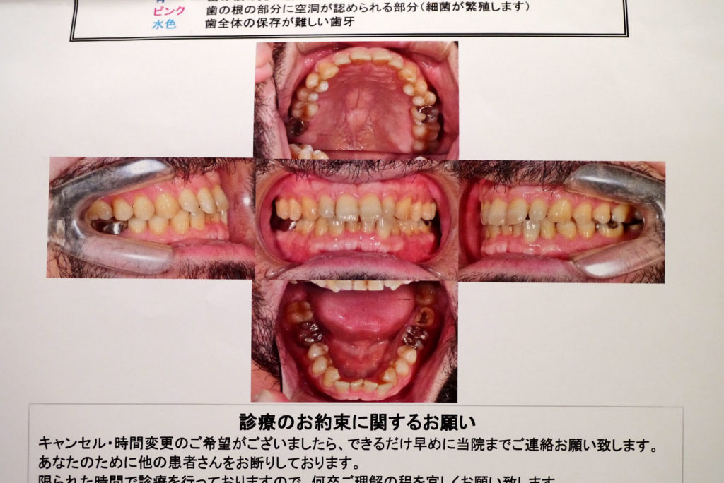 My Oral Cavity Image by dentsit