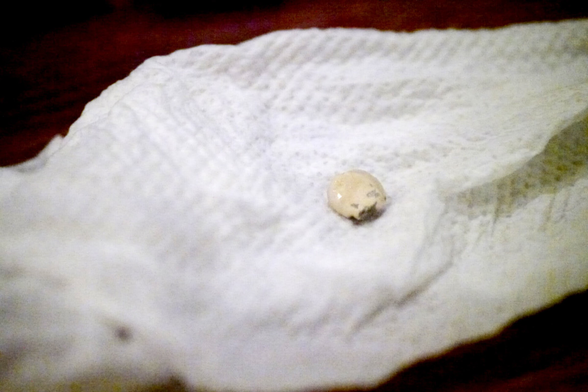Broken Tooth