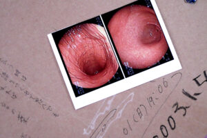 The photo of gastroscopy on the sketchbook